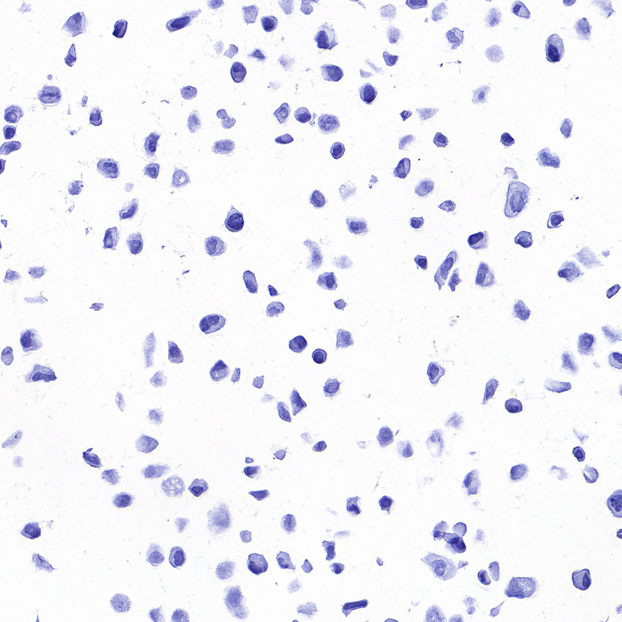 STEAP1 Recombinant Rabbit mAb (S-3613-107)