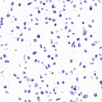 STEAP1 Recombinant Rabbit mAb (S-3613-107)