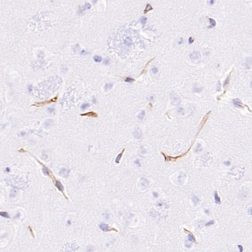 CD105 Recombinant Rabbit mAb (S-3764-11)