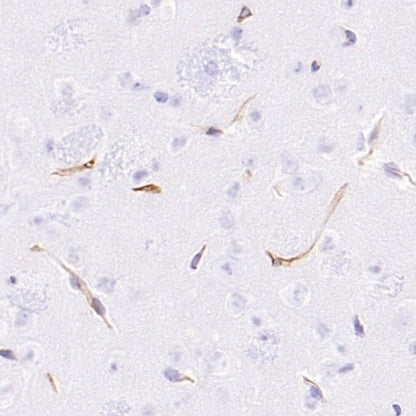 CD105 Recombinant Rabbit mAb (S-3764-11)
