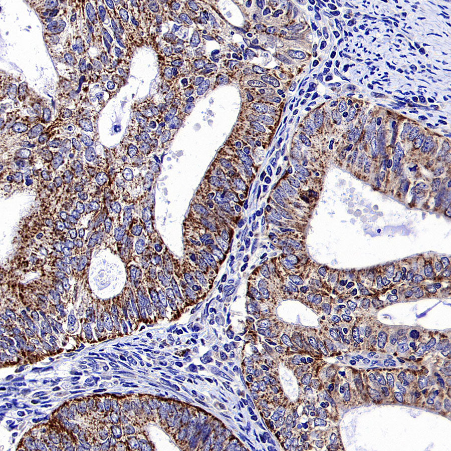 CHCHD2 Recombinant Rabbit mAb (S-4107-30)