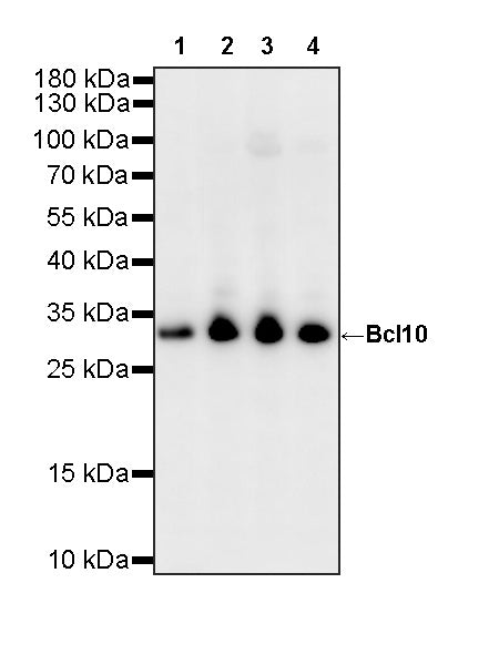 Bcl10 Recombinant Rabbit mAb (S-4116-60)