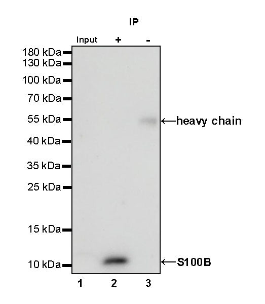 S-RMab® S100B Recombinant Rabbit mAb (SDT-518-45)