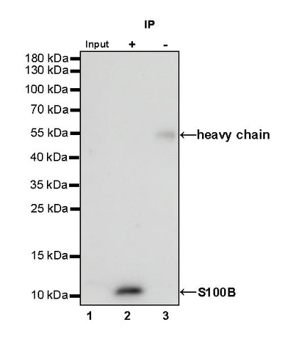 S-RMab® S100B Recombinant Rabbit mAb (SDT-518-45)