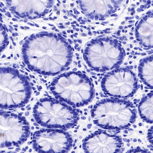 Uroplakin III Recombinant Rabbit mAb (SDT-R177)