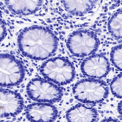 Uroplakin III Recombinant Rabbit mAb (SDT-R177)