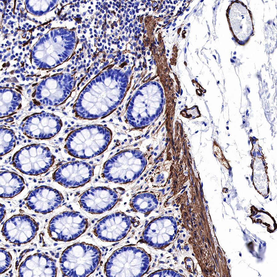 alpha smooth muscle Actin (SMA) Recombinant Rabbit mAb,PBS Only (SDT-132-63)