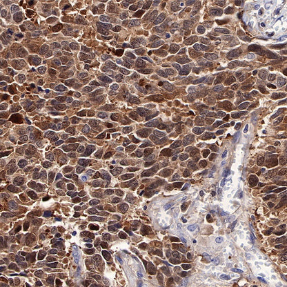 ST13 Recombinant Rabbit mAb (S-661-38)
