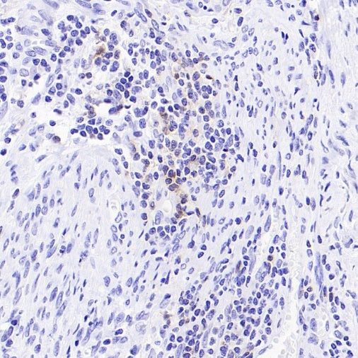 TIGIT Recombinant Rabbit mAb (S-4600)