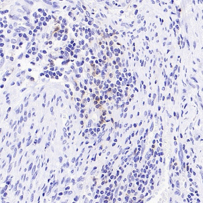 TIGIT Recombinant Rabbit mAb (S-4600)