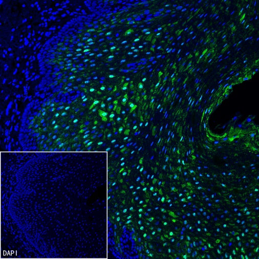 SERPINB3 Recombinant Rabbit mAb (S-4587)