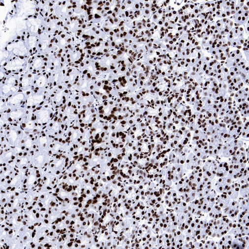Histone H4 (Lactyl K8) Recombinant Rabbit mAb (S-3243-36)
