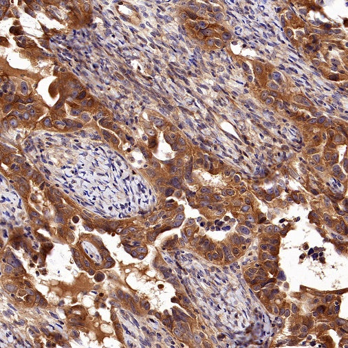 NF-κB2 p100 Recombinant Rabbit mAb (S-2502-62)