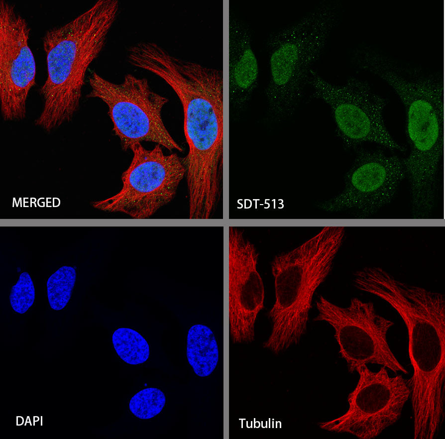 Topoisomerase II alpha Recombinant Rabbit mAb (S-513-7)