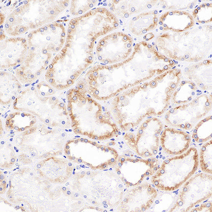 Alpha Tubulin Recombinant Mouse mAb (S-5704)