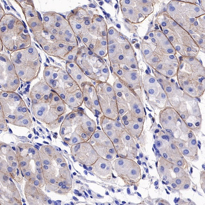 DAG1 Recombinant Mouse mAb (S-R191)