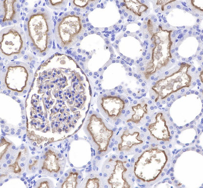CD10 Recombinant Rabbit mAb (SDT-006-77)