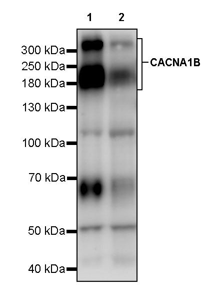 CACNA1B Recombinant Rabbit mAb (S-2992-33)
