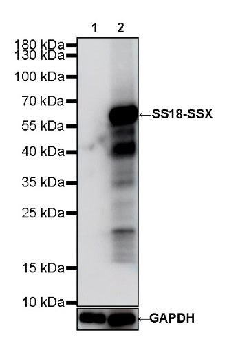 SS18-SSX Recombinant Rabbit mAb (SDT-4202)