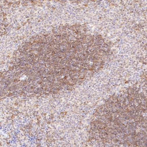 CD100/Semaphorin-4D Recombinant Rabbit mAb (S-3651-16)