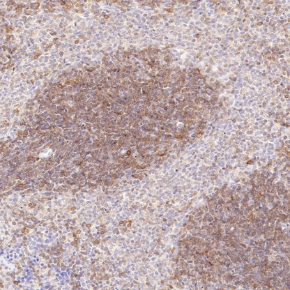 CD100/Semaphorin-4D Recombinant Rabbit mAb (S-3651-16)