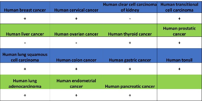 JAK1 Recombinant Rabbit mAb (S-1819-142)