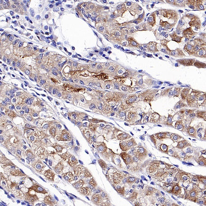 Acetyl-CoA Carboxylase Recombinant Rabbit mAb (S-2220-96)