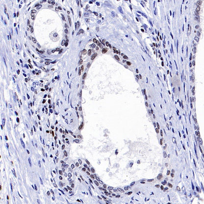 Runx2 Recombinant Rabbit mAb (S-1767-173)