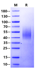 Plectin His Tag Protein, Human