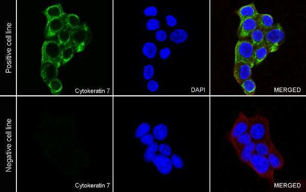 Cytokeratin 7 Recombinant Rabbit mAb (SDT-R028)
