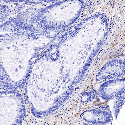 FAP Recombinant Rabbit mAb,PBS Only (SDT-R132)