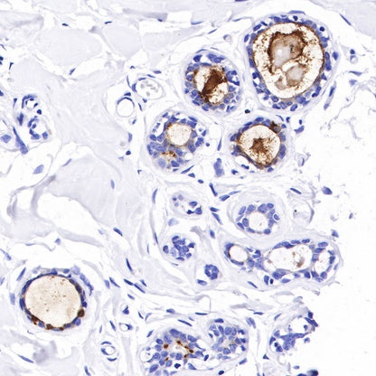 B7-H4 Recombinant Rabbit mAb (SDT-314-447-2)