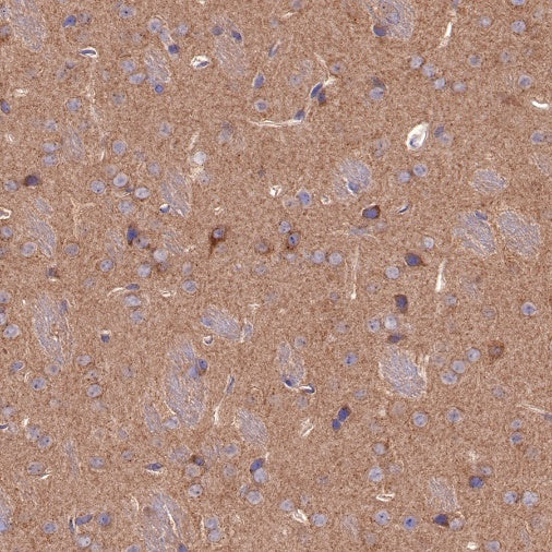 SQSTM1/p62 Recombinant Rabbit mAb (S-R346)