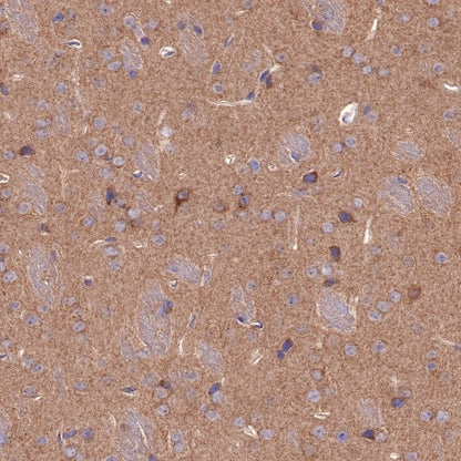 SQSTM1/p62 Recombinant Rabbit mAb (S-R346)