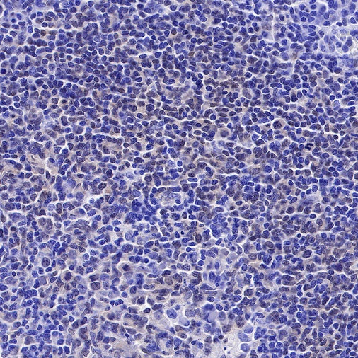 PAX5 Recombinant Rat mAb (S-R200)
