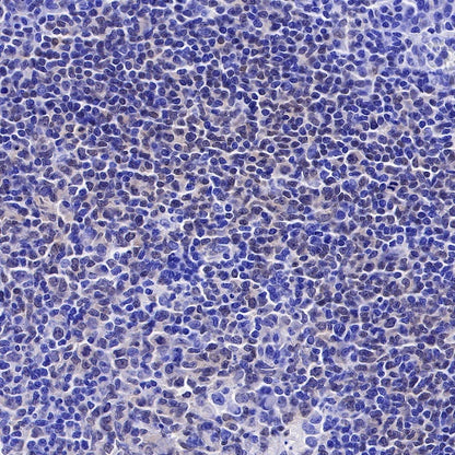 PAX5 Recombinant Rat mAb (S-R200)