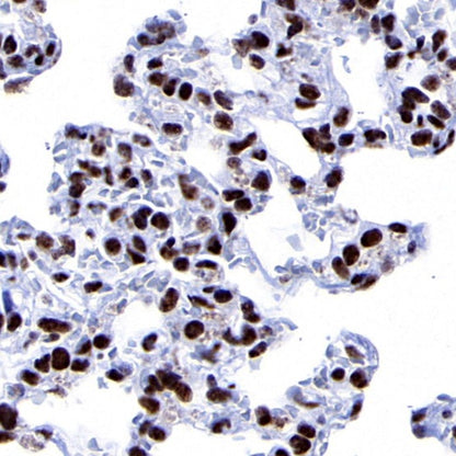 PPARγ Recombinant Rabbit mAb (SDT-556-108)