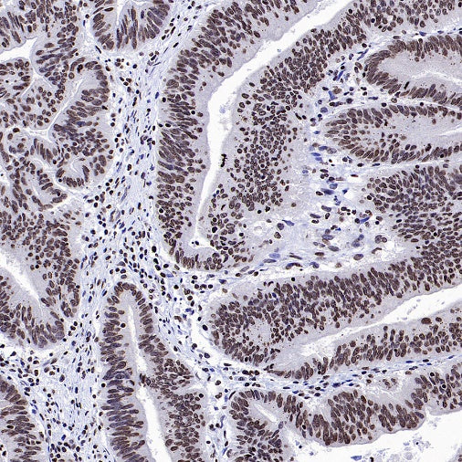 Histone H2A.X Recombinant Rabbit mAb (S-1772-179)