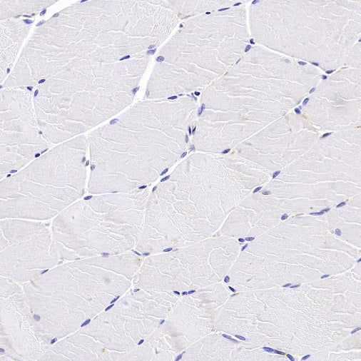 Beta I tubulin Recombinant Rabbit mAb (S-3108-63)