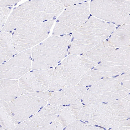 Beta I tubulin Recombinant Rabbit mAb (S-3108-63)