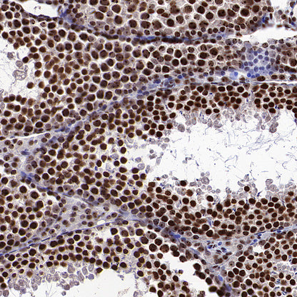NPM1 Rabbit Polyclonal Antibody