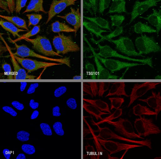 TSG101 Recombinant Rabbit mAb (S-1868-76)