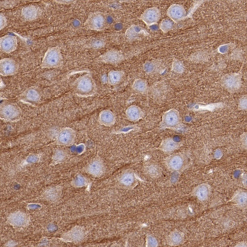 α-tubulin Rabbit Polyclonal Antibody