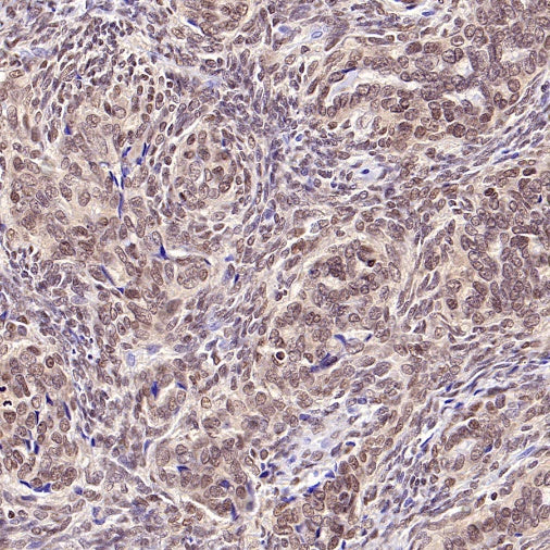 SS18-SSX Recombinant Rabbit mAb (SDT-4202)