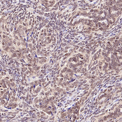 SS18-SSX Recombinant Rabbit mAb (SDT-4202)