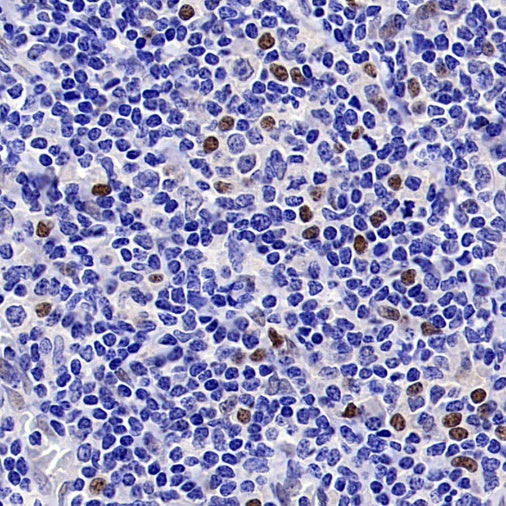 TCF-4 Recombinant Rabbit mAb (SDT-2549-4)