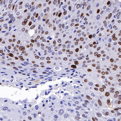 p14ARF Recombinant Rabbit mAb (S-R244)