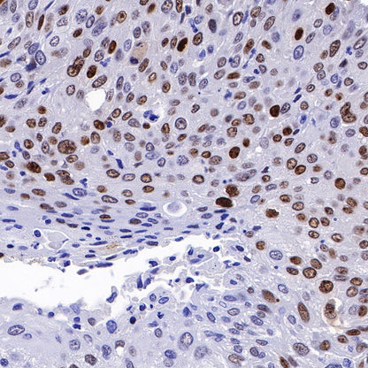 p14ARF Recombinant Rabbit mAb (S-R244)