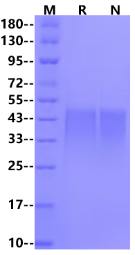 TREM-1/CD354 His Tag Protein, Mouse