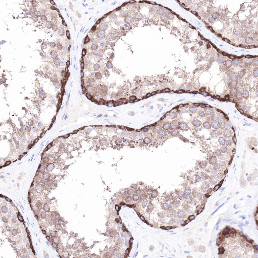 Hsp90 beta Recombinant Rabbit mAb (SDT-R033)